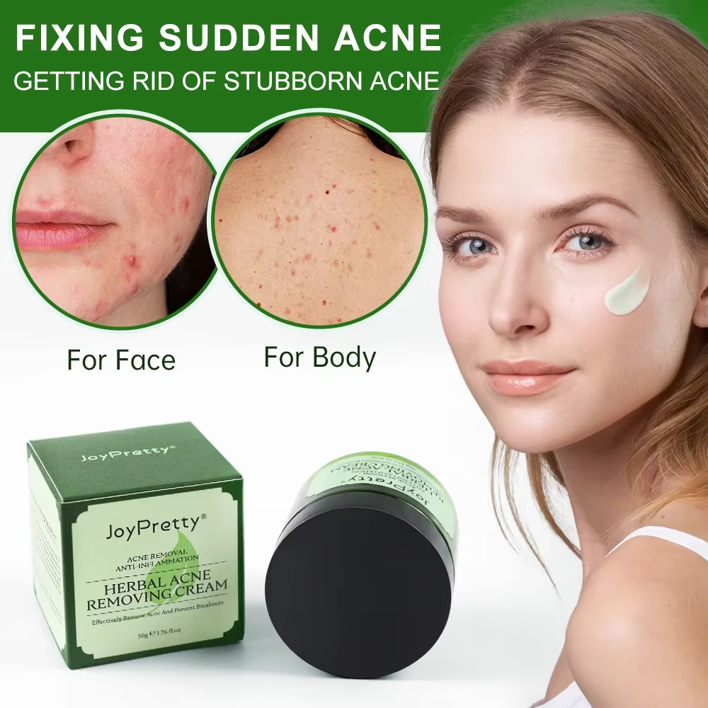 Skincare Herbal - JoyPrettyin Herbal Acne Face Cream Pimple