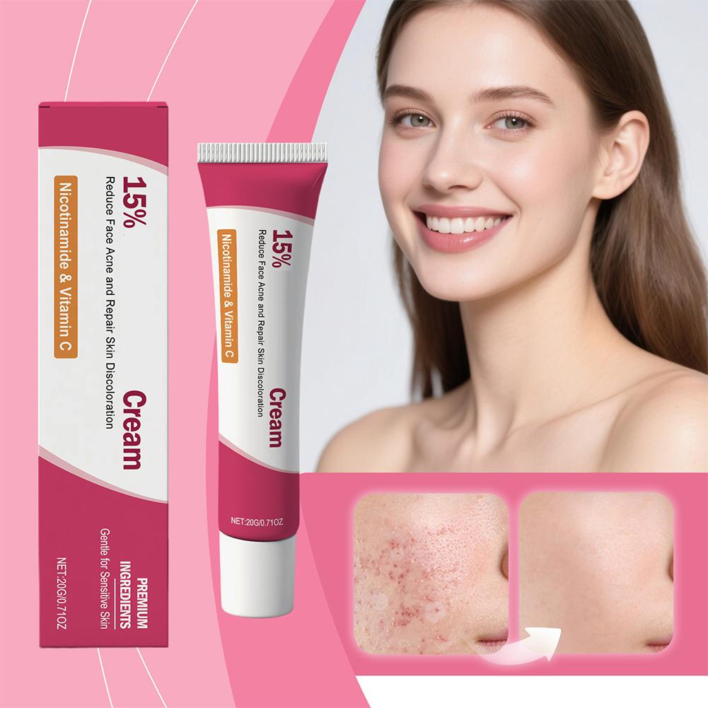 Soothing Acne Treatment Cream, - Skincare Herbal ulasan dan harga