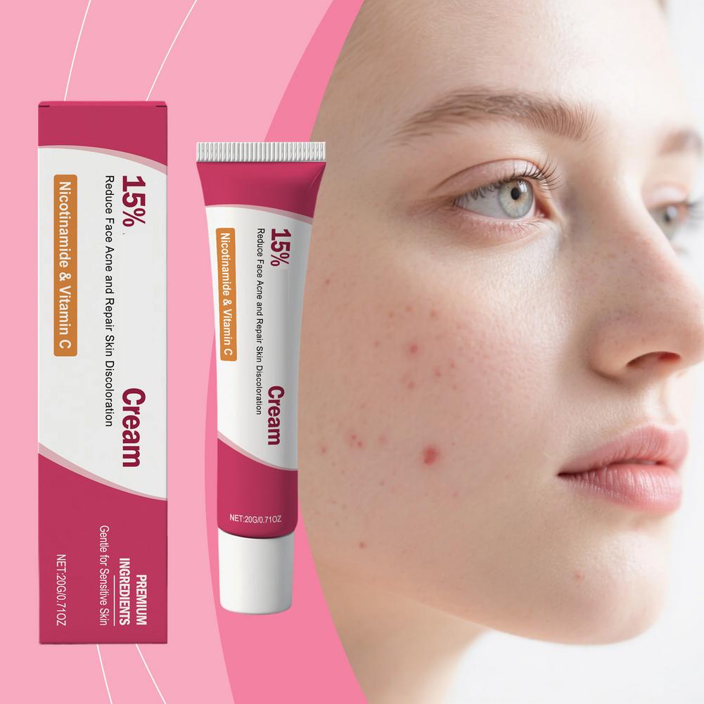 Soothing Acne Treatment Cream, - Skincare Herbal ulasan dan harga