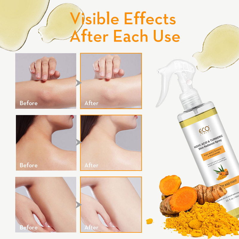 Kojic Acid & Turmeric Skin Bri - Skincare Niacinamide ulasan dan harga